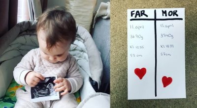 pseudotvillinger-gravid-baby